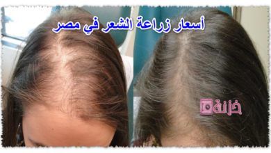 أسعار زراعة الشعر في مصر