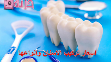 اسعار تركيب الاسنان وانواعها